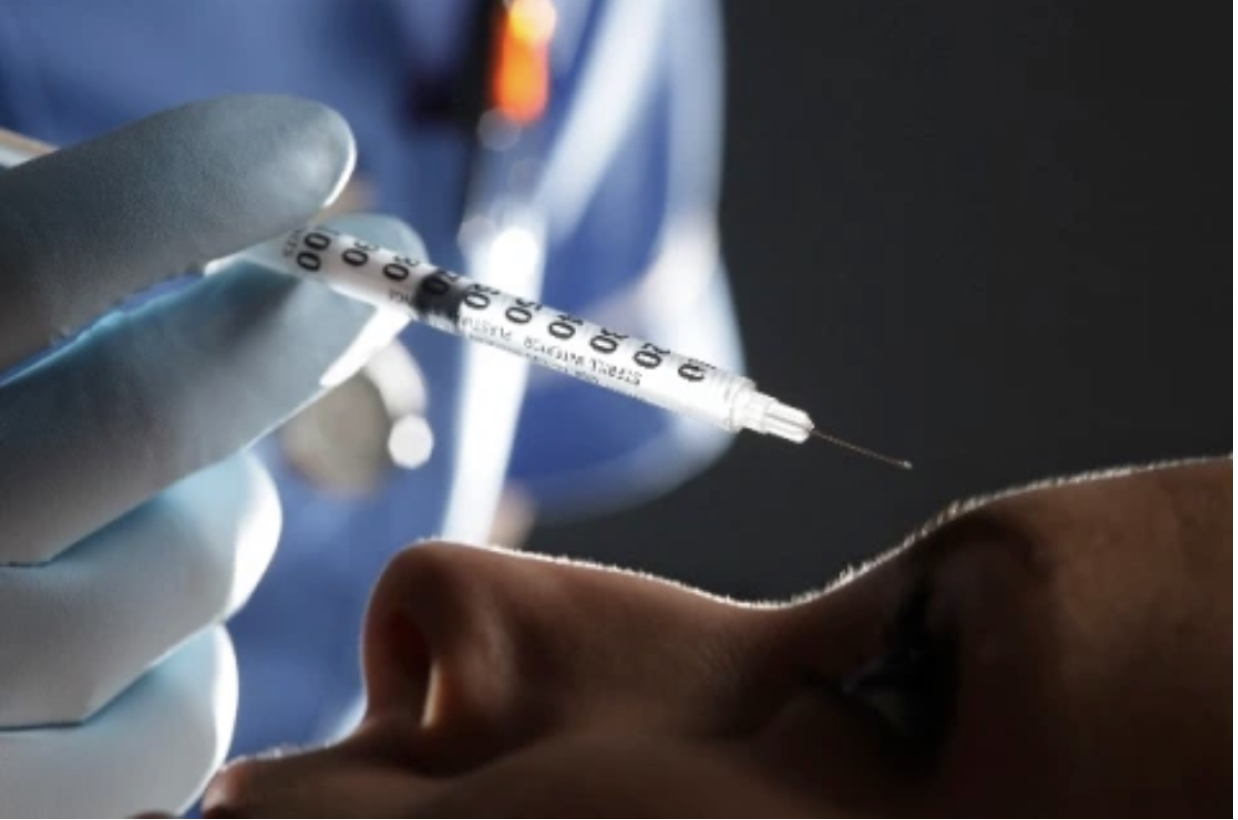 Botox injections for migraines
                                                          